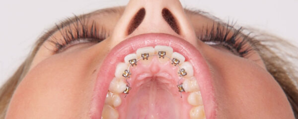 Orthodontie