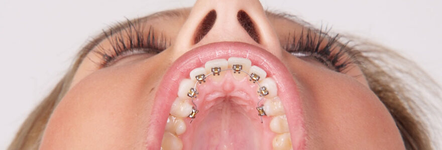 Orthodontie